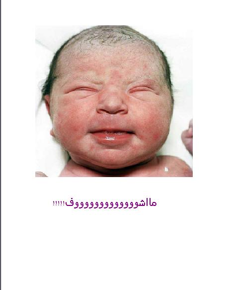 صور متنوعة صور مواليد التقطت بعد ثواني س12 Size:22.40 Kb Dim: 473 x 583 Size: Kb Dim: x