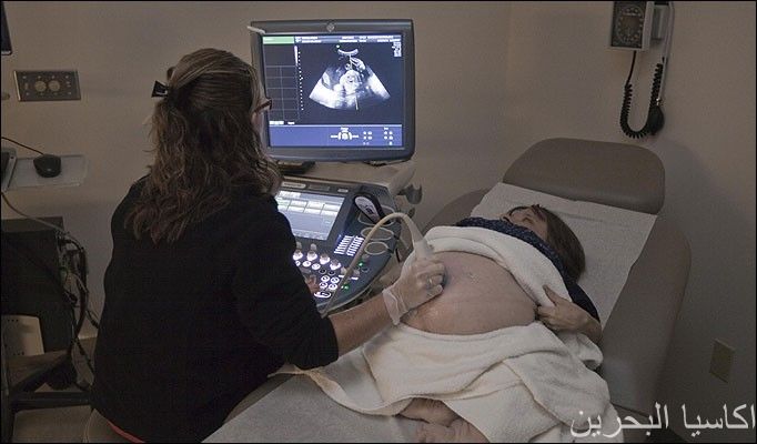 غرائب الصور اصغر ام في العالم .. طولها 712 Size:42.20 Kb Dim: 682 x 400 Size: Kb Dim: x