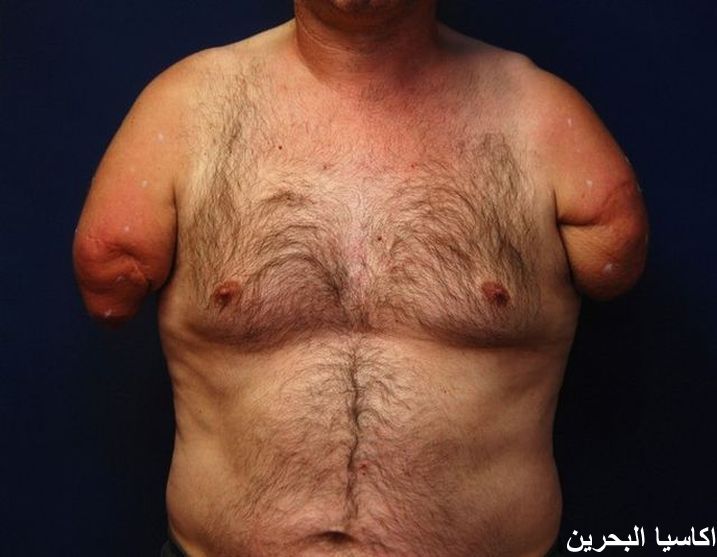 صور متنوعة معجزة طبية عظيمة1 Size:48.50 Kb Dim: 717 x 557 Size: Kb Dim: x