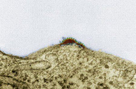 صور متنوعة صورة حقيقية لفيروس الإيدز 2 Size:36.80 Kb Dim: 450 x 295 Size: Kb Dim: x